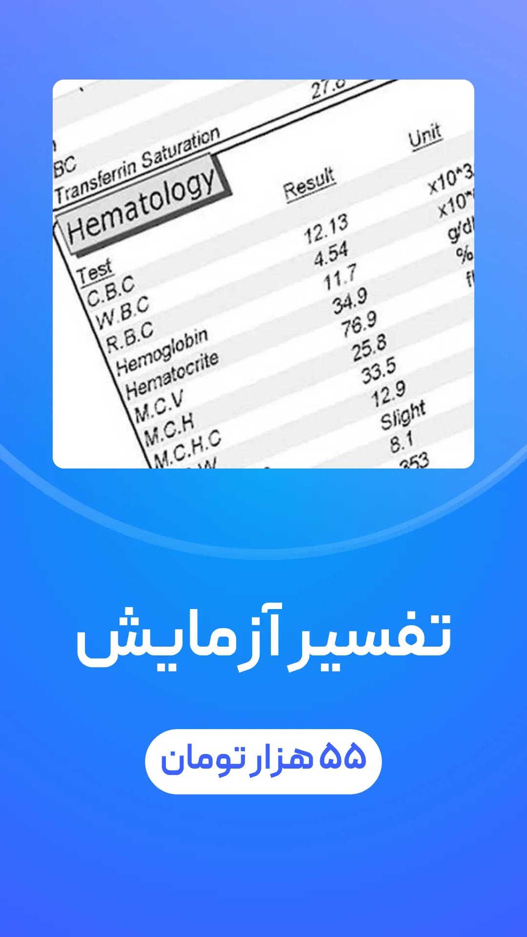 تفسیر آزمایش با هوش مصنوعی