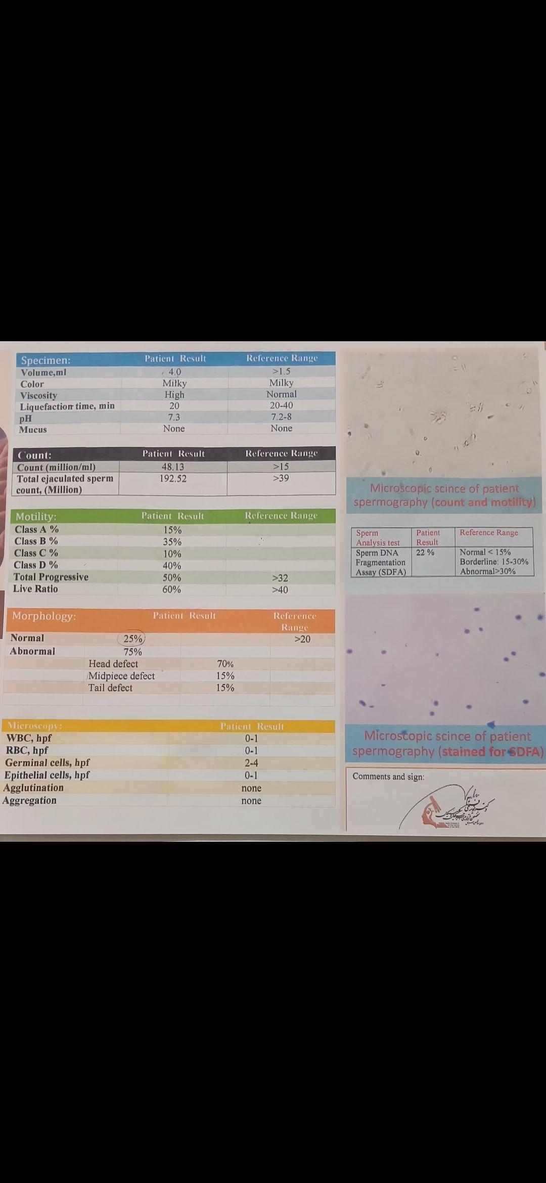 تصویر  آزمایش اسپرم