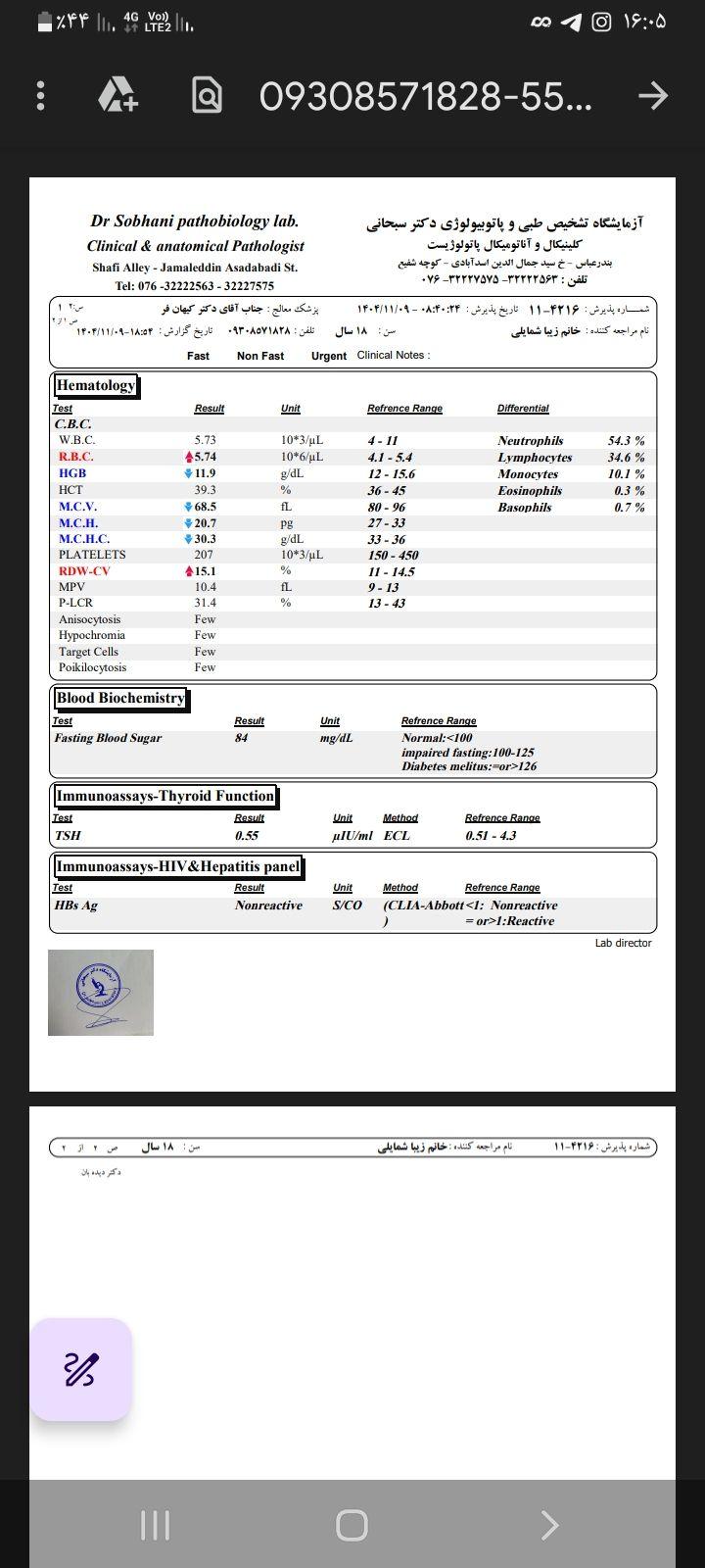 تصویر  آزمایش