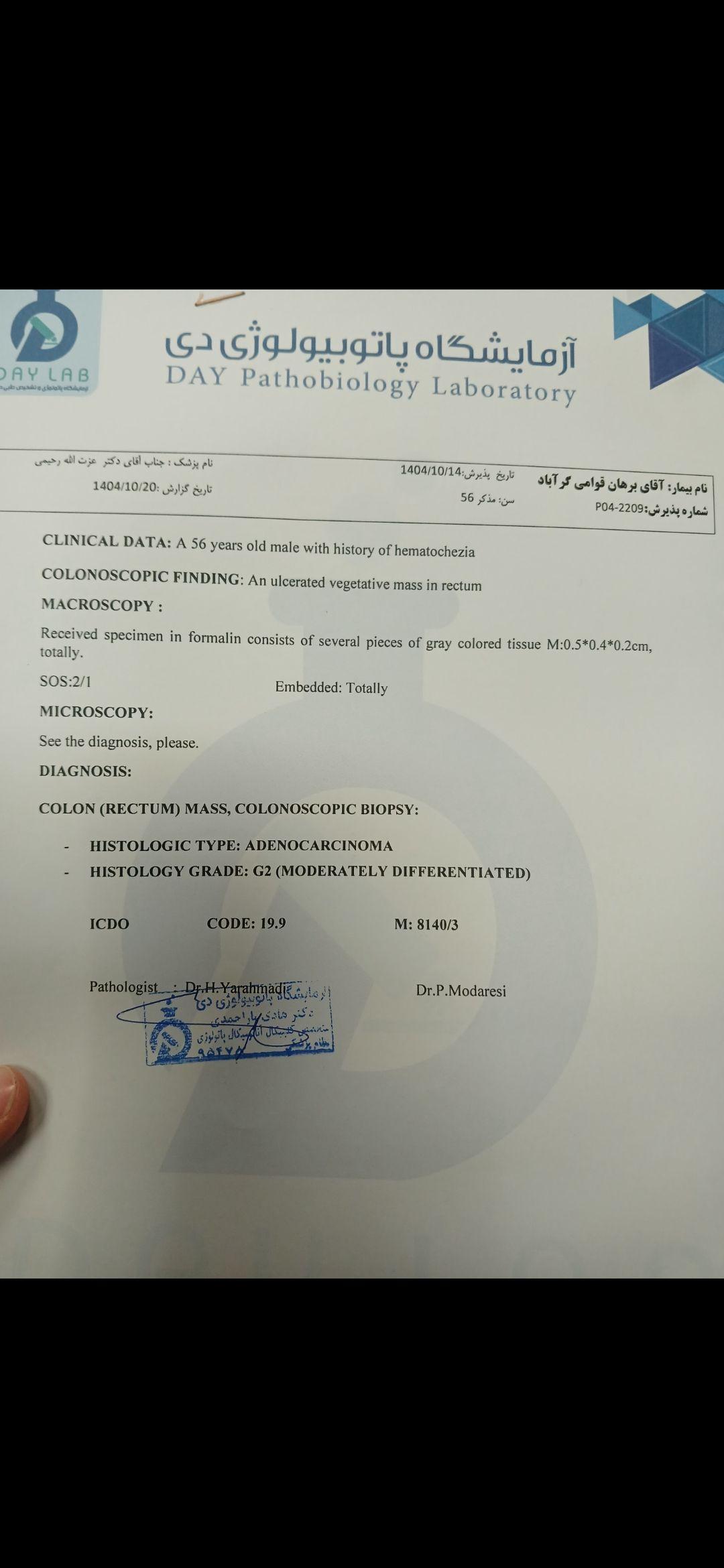 تصویر  کولونوسکوپی 