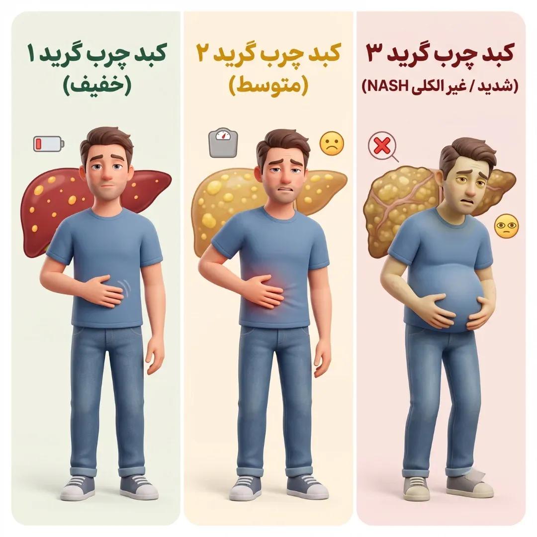 علائم کبد چرب