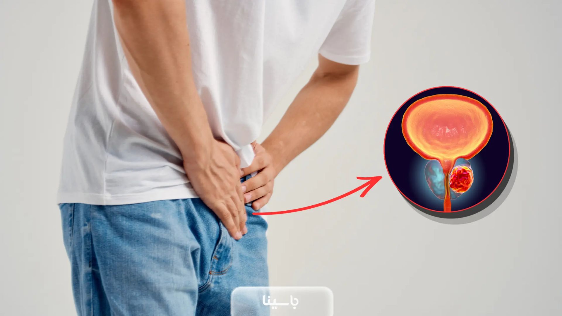 پروستات چیست؟ پروستات مرد کجاست؟ علائم مشکلات پروستات چه هستند؟