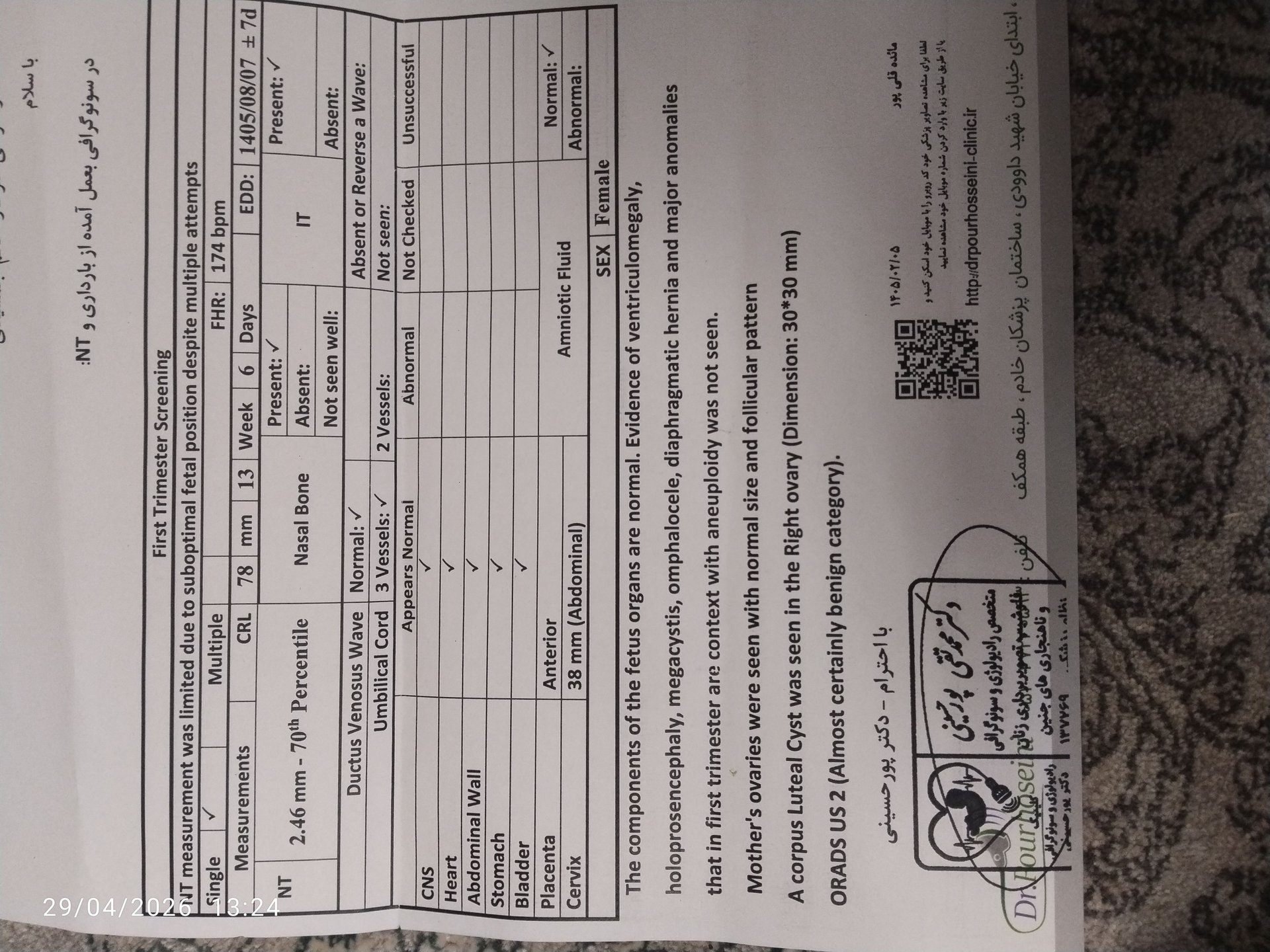 تصویر غربالگری اول