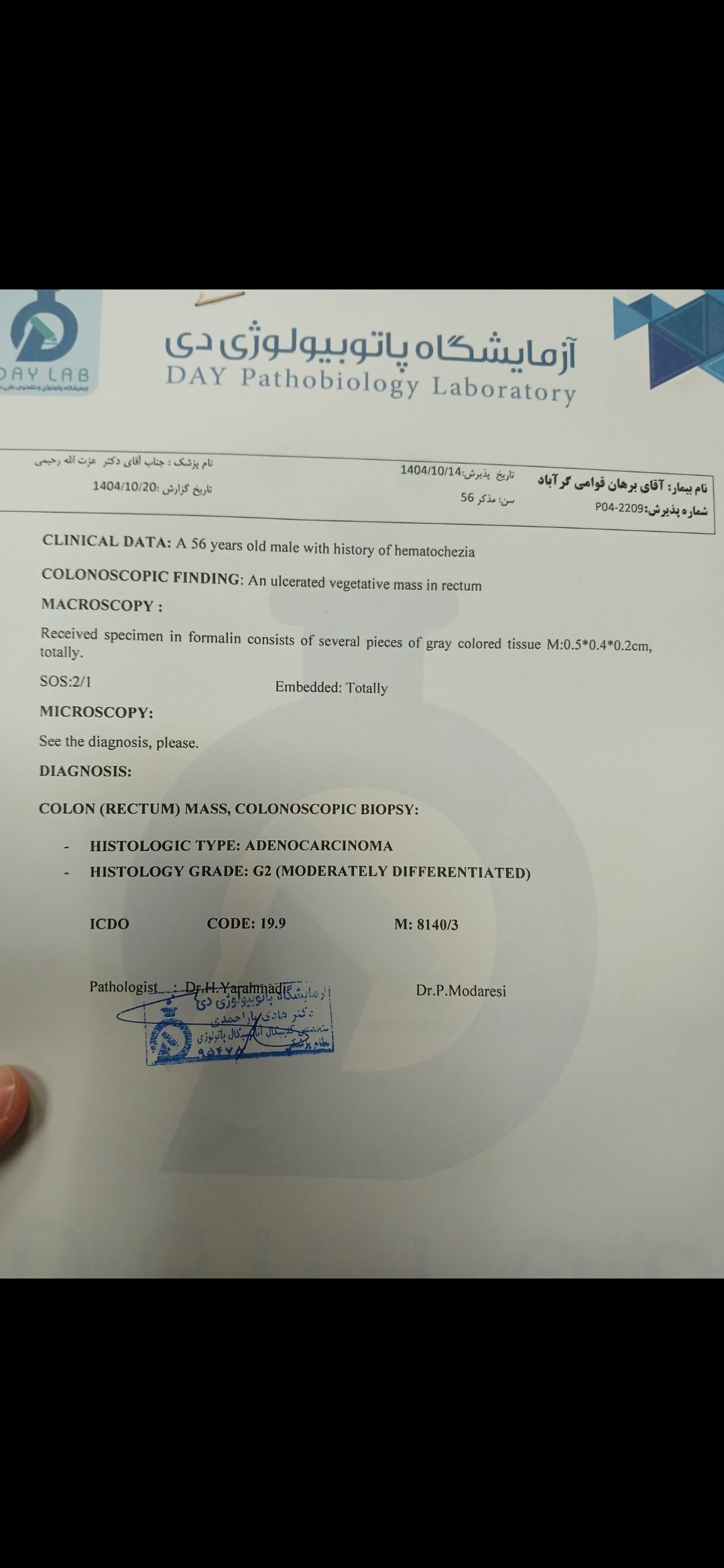 تصویر کولونوسکوپی 
