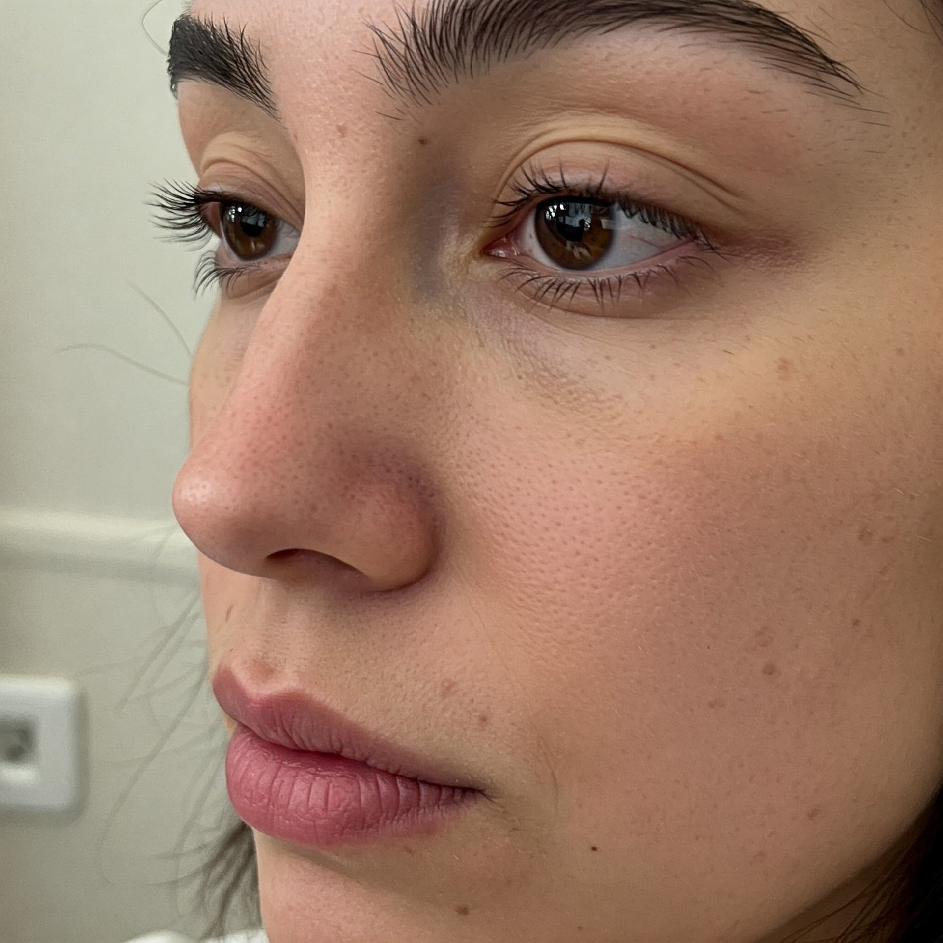 تصویر ظاهر بینی‌م خوبه، اما از تو داغونه! کسی عمل بدون تغییر فرم انجام داده؟