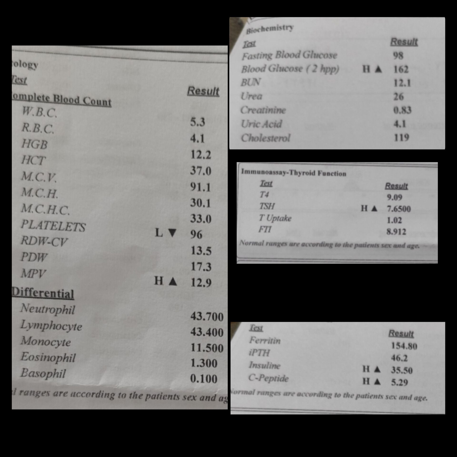 تصویر چکاب قبل از عمل اسلیومعده