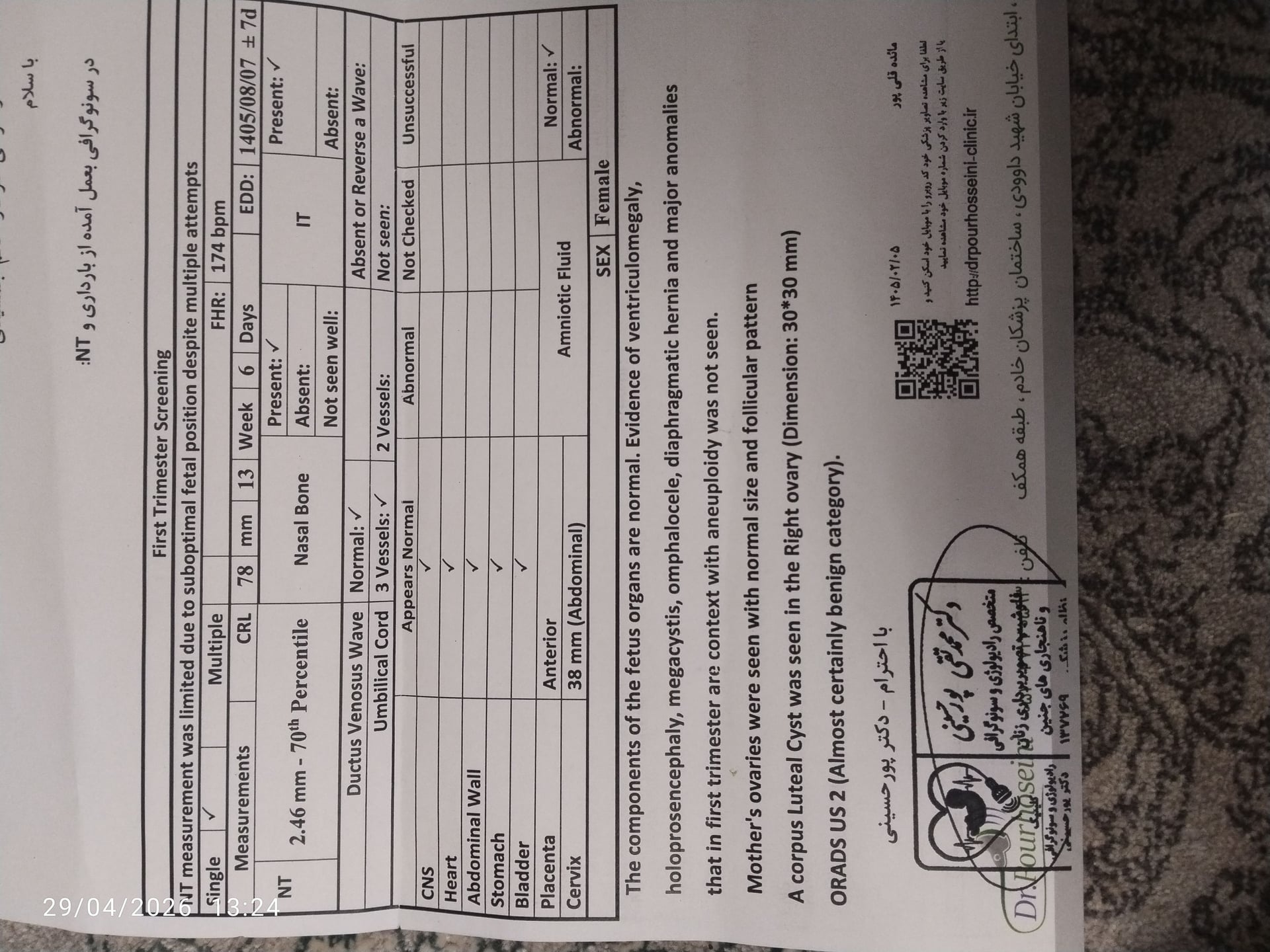 تصویر غربالگری اول