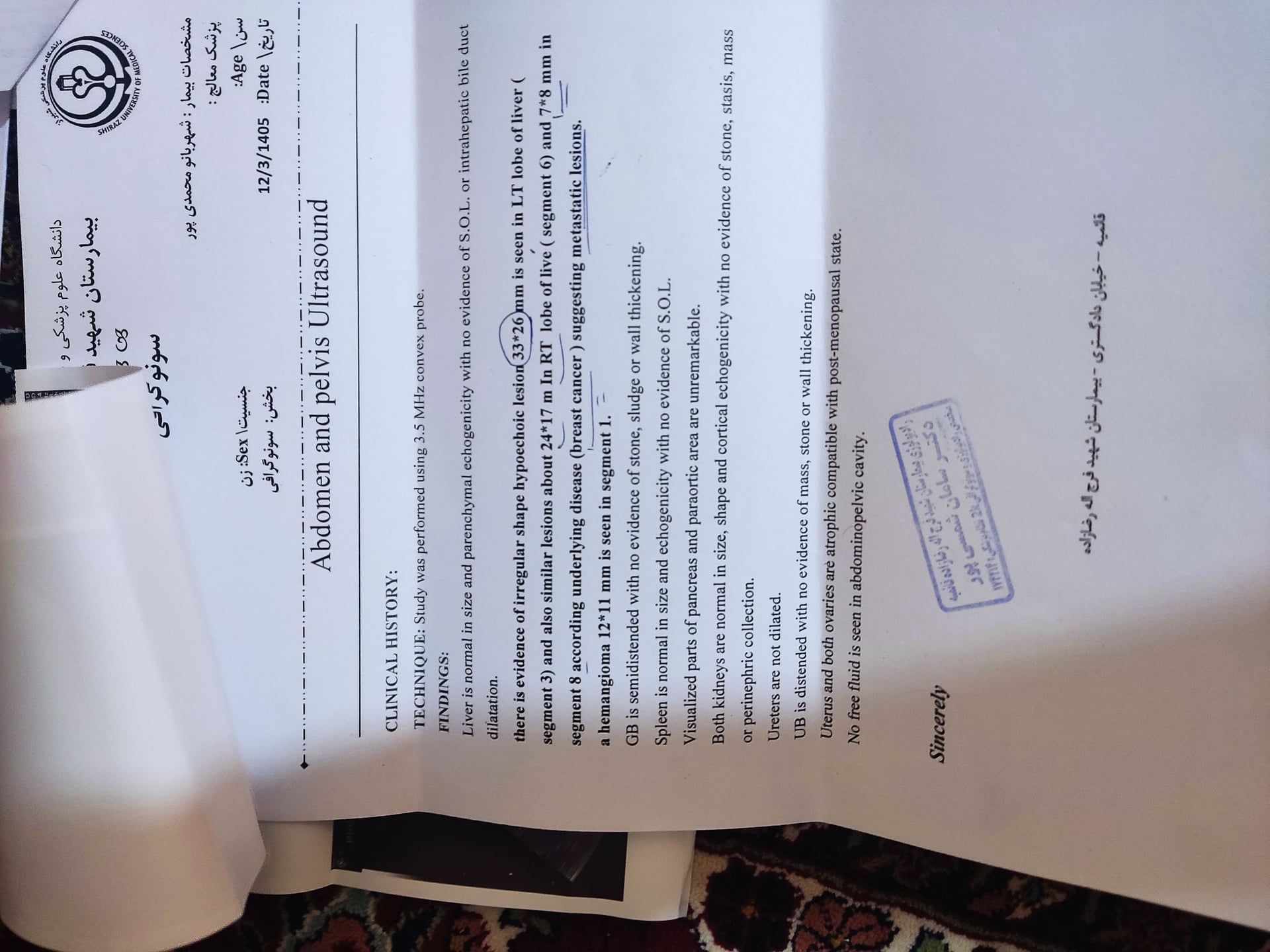 تصویر سونوگرافی