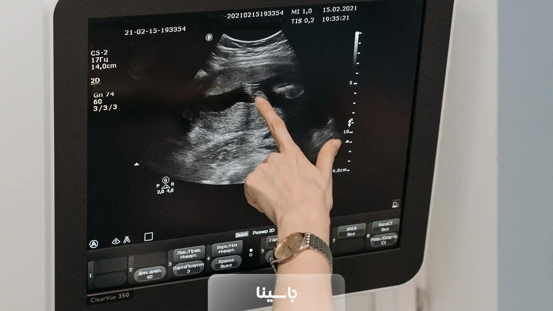 آزمایش دابل مارکر + راهنمای مادران باردار برای تفسیر آنلاین با هوش مصنوعی