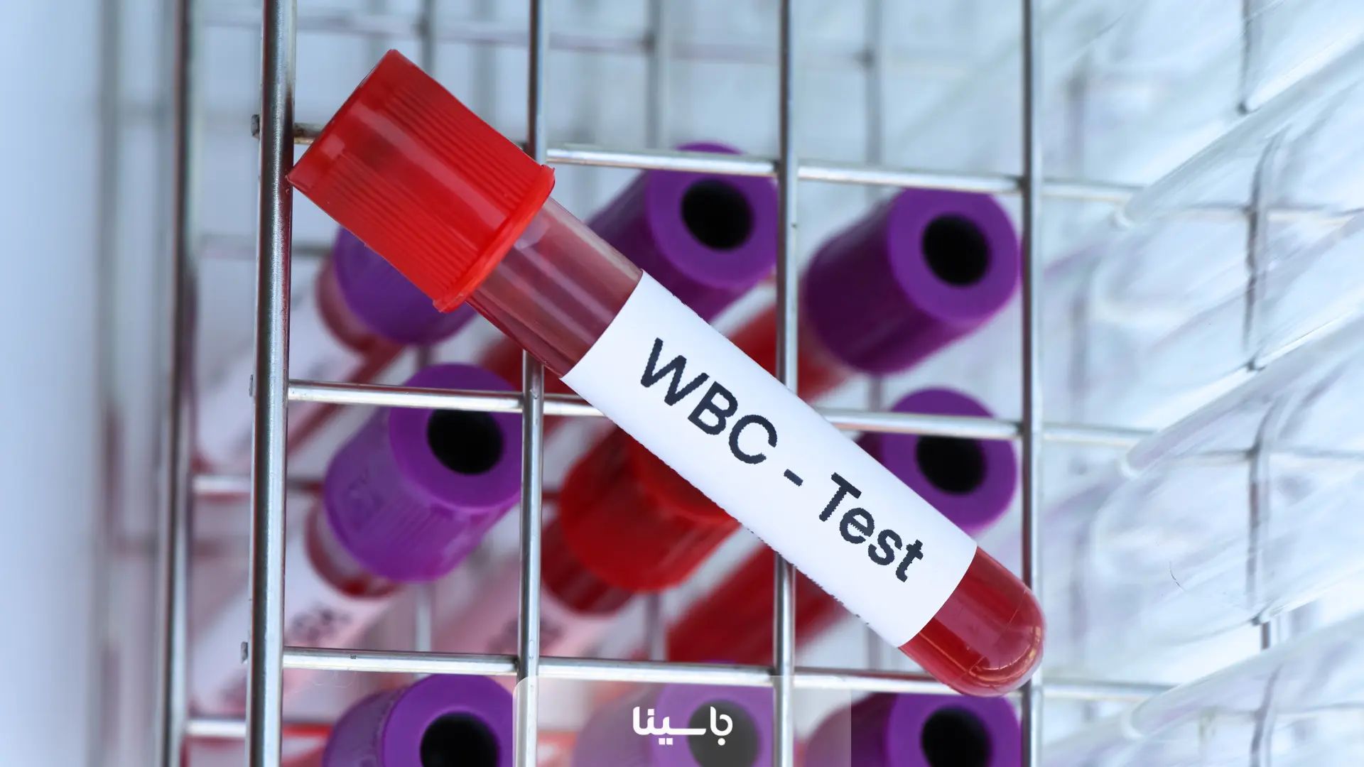 WBC در آزمایش خون