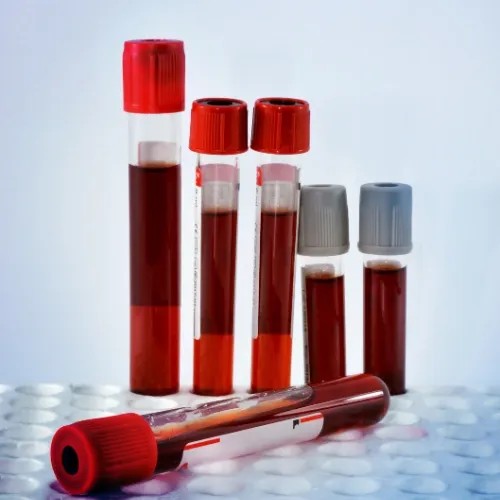 تفسیر آزمایش خون