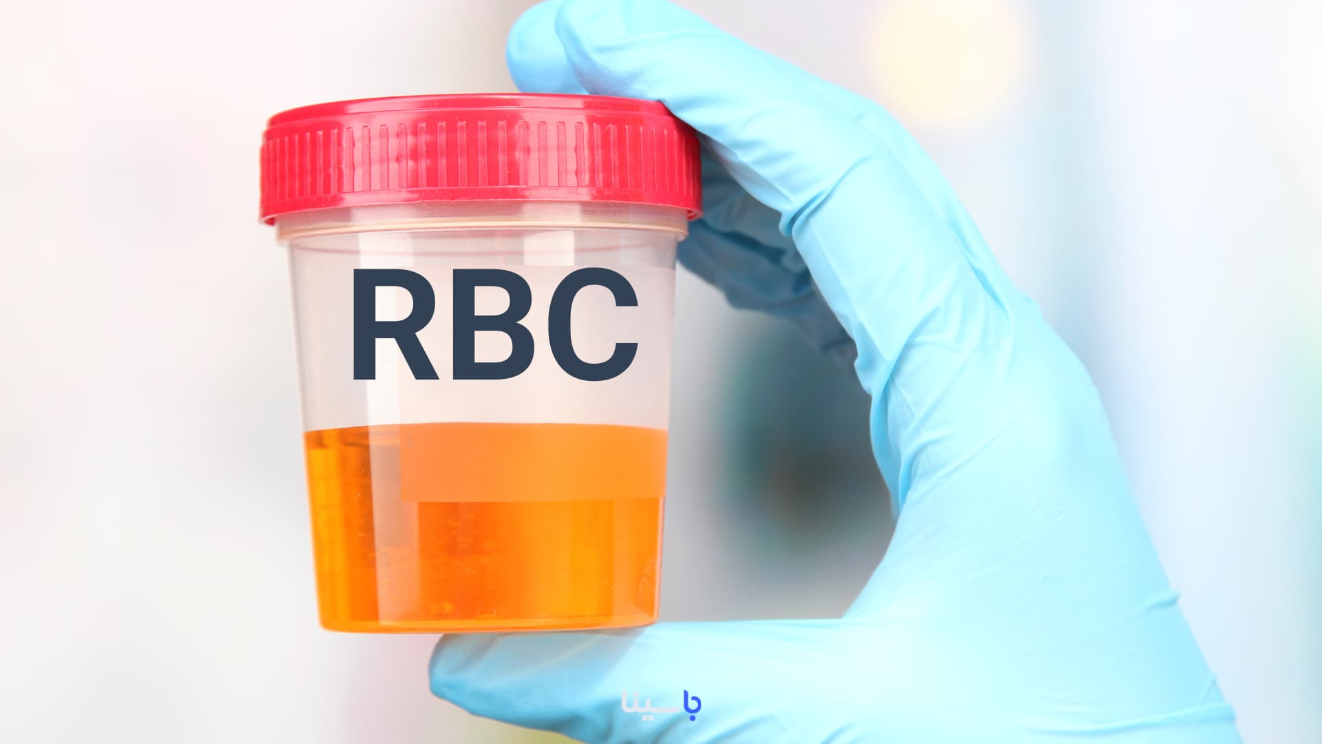 RBC در آزمایش ادرار