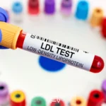 LDL در آزمایش خون