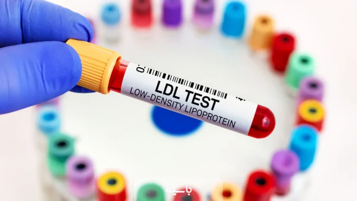 LDL در آزمایش خون