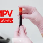 MPV در آزمایش خون