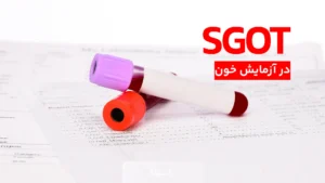 SGOT در آزمایش خون