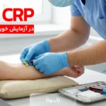crp در آزمایش خون