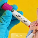 رنج نرمال ESR در زنان چند است؟