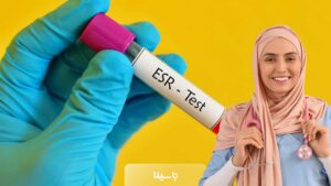 رنج نرمال ESR در زنان چند است؟