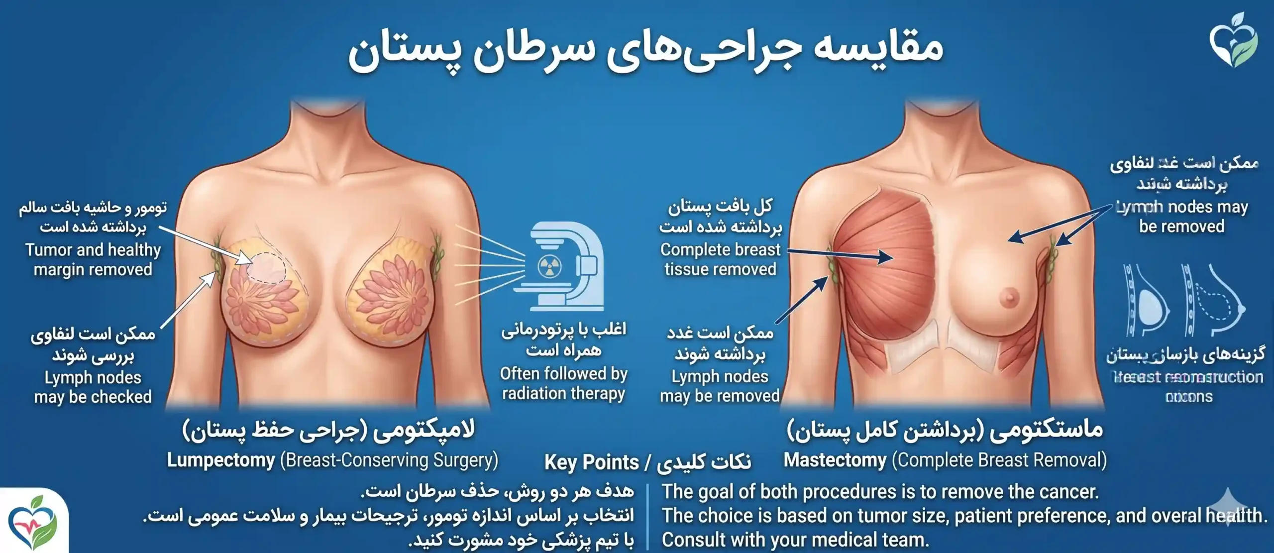 انواع جراحی‌ها در عمل سرطان سینه بدخیم