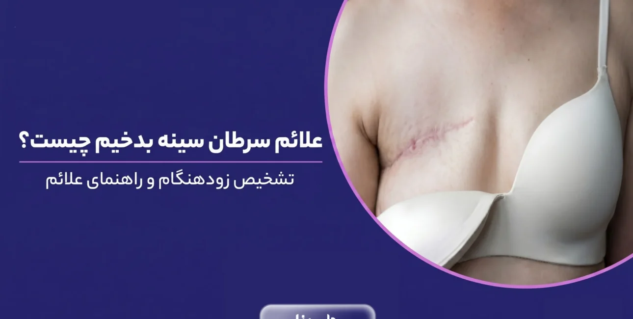 علائم سرطان سینه بدخیم