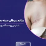 علائم سرطان سینه بدخیم